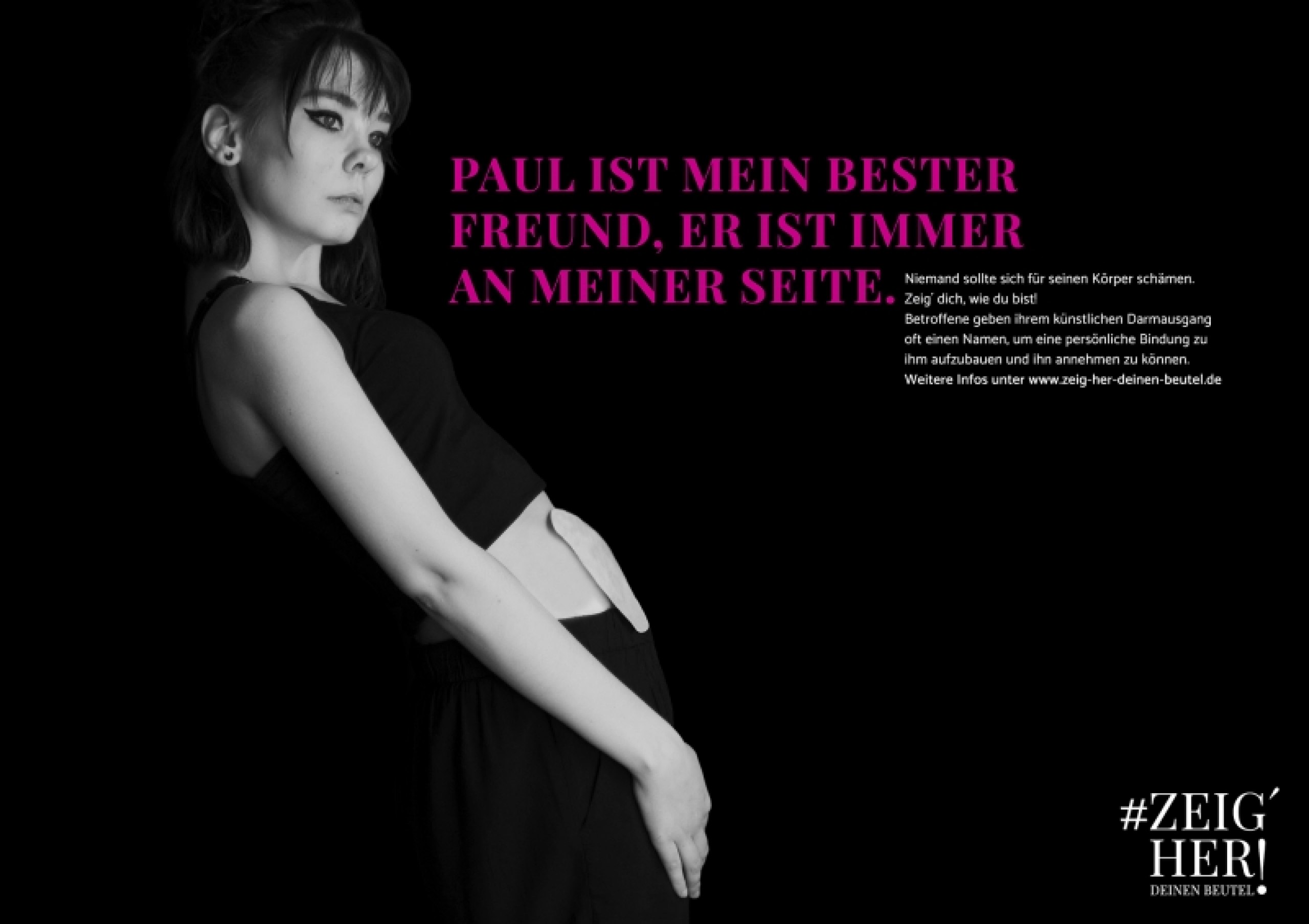 Ästhetisierung von Stomabeuteln und Entwicklung einer Kampagne
