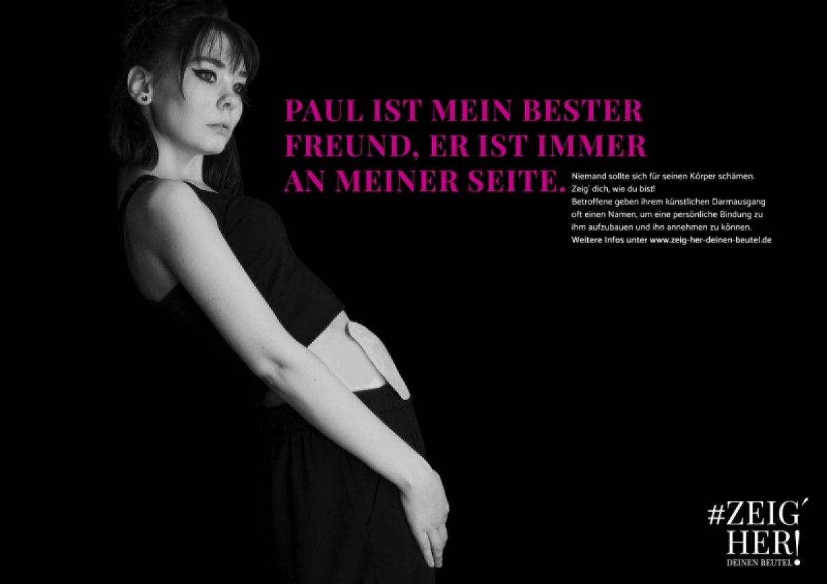 Ästhetisierung von Stomabeuteln und Entwicklung einer Kampagne