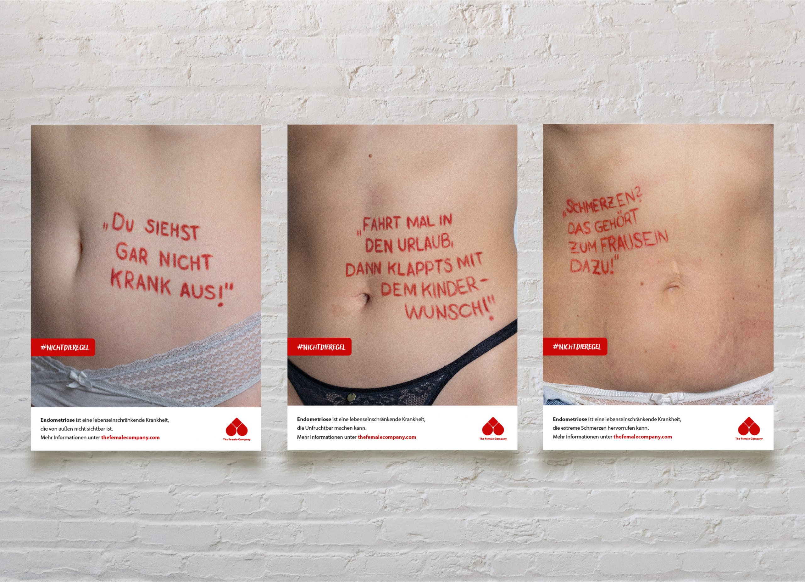 Eine Awareness Kampagne zur Sensibilisierung und Aufklärung der chronischen Erkrankung Endometriose