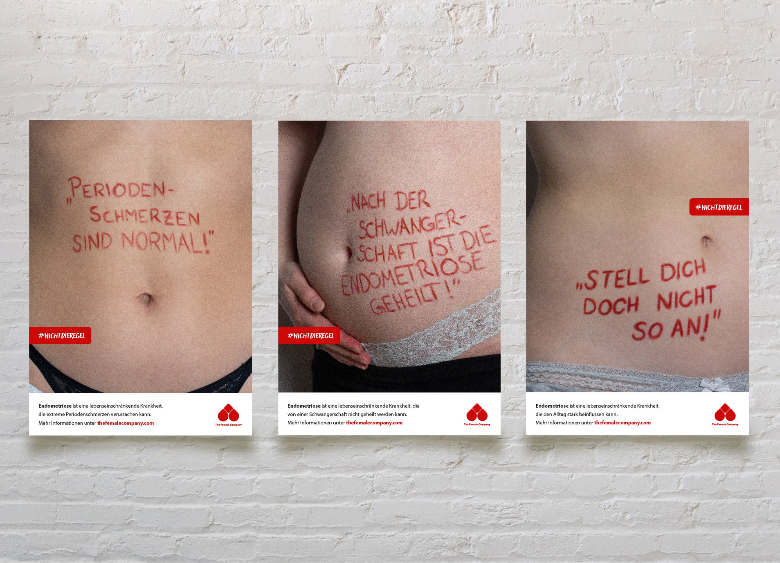 Eine Awareness Kampagne zur Sensibilisierung und Aufklärung der chronischen Erkrankung Endometriose