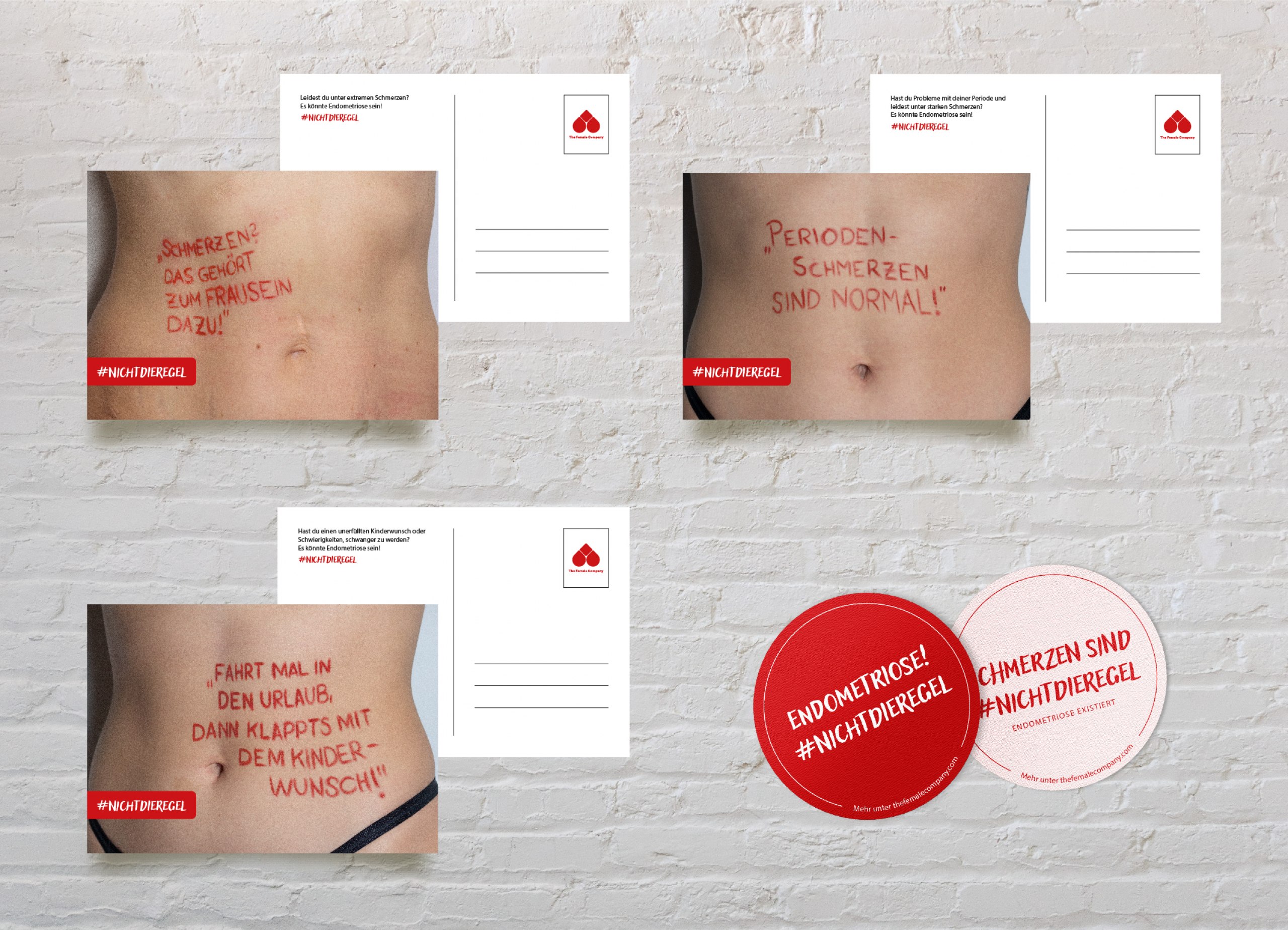 Eine Awareness Kampagne zur Sensibilisierung und Aufklärung der chronischen Erkrankung Endometriose