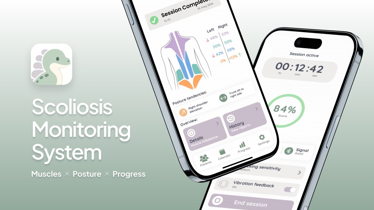 Kinderfreundliches Wearable-System für biomechanisches Monitoring bei Skoliose